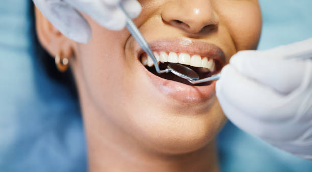 Best Emergency Tooth Extraction in Prospect, OH